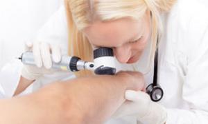 Skin Cancer—The Basics